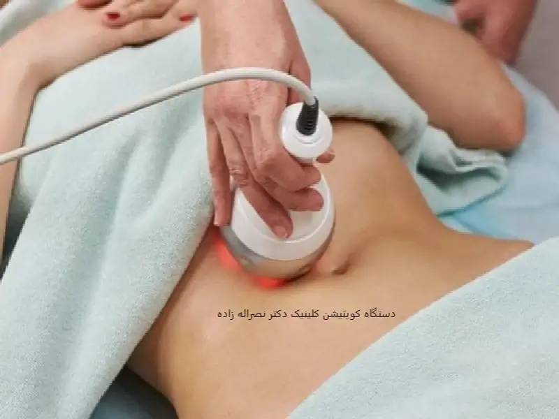 مرکز لاغری ما ارائه دهنده بهترین دستگاه لاغری شکم است که شامل خدماتی مانند RF و مزوتراپی می‌باشد.