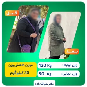 دستگاه کرایو برای چیست ؟